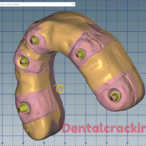 ceramill software