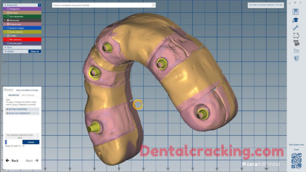 ceramill software