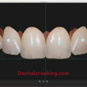 smile designer pro dental sotware