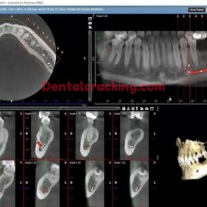 Romexis Planmeca 6.4.6 crack