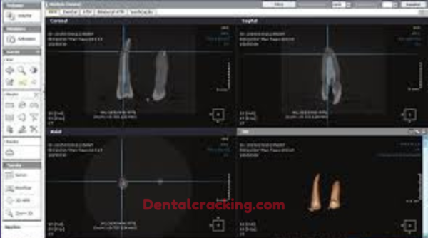 ondemand 3d