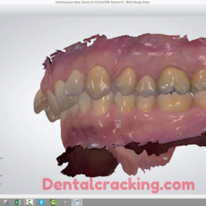 3shape Ortho System 2023 crack