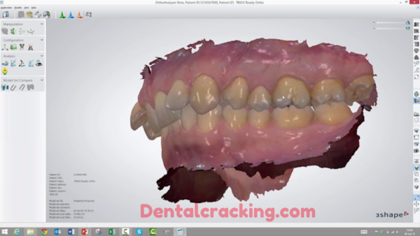 3shape Ortho System 2023 crack