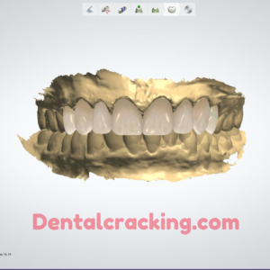 3shape Dental system