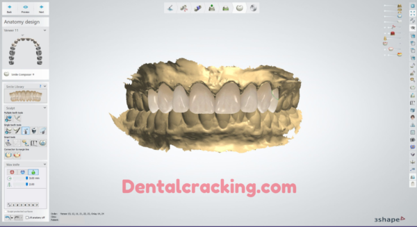 3shape Dental system