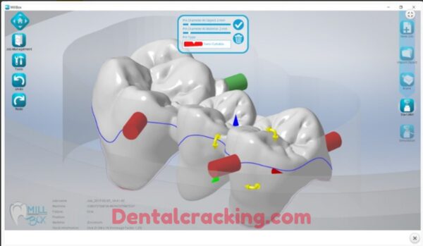 sum3d dental software download