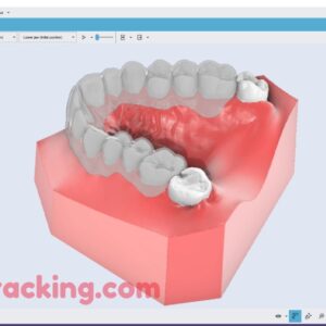 hyperdent software