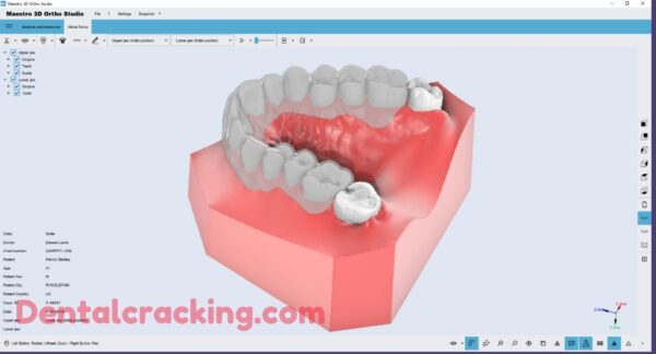 hyperdent software