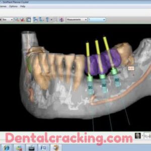 Simplant crack