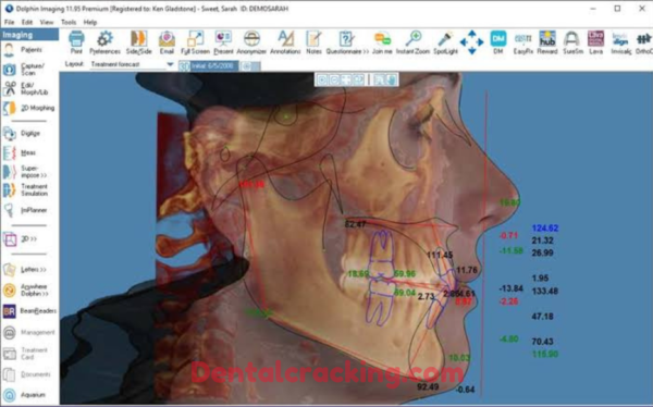 dolphin imaging software