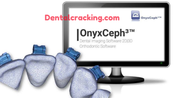 Onyxceph 3.2.211 crack