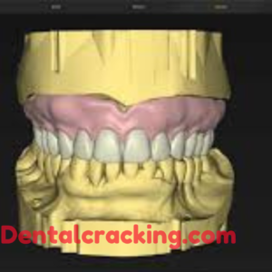 inlab 22.1 crack