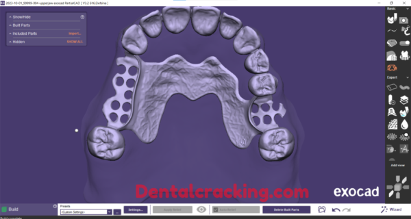Exocad 3.2 elefsina crack build 8020 (2024) - Image 4
