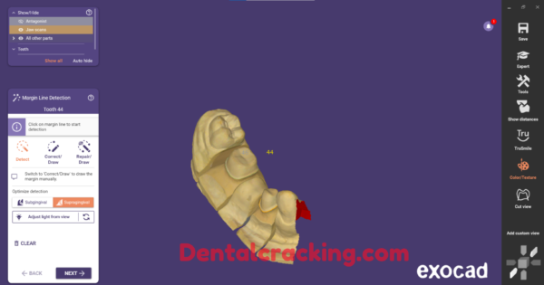 Exocad 3.2 elefsina crack build 8020 (2024) - Image 5