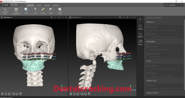 IPS case designer 2.5.7.1 crack (2024) - Image 4