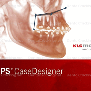 ips case designer