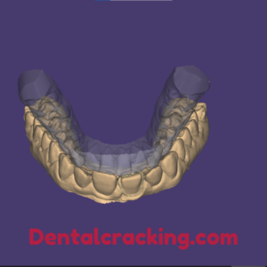 exocad dental​ software​ download
