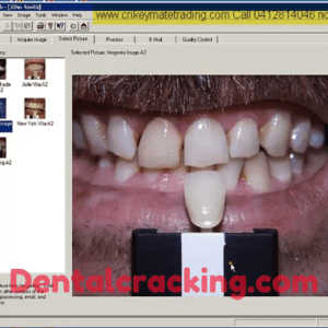 clearmatch dental