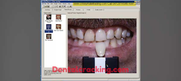 clearmatch dental