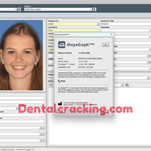 Onyxceph Download