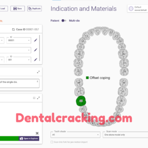 exocad dentalcad download​