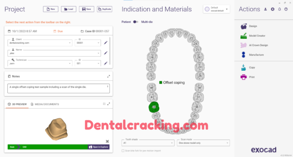 exocad dentalcad download​