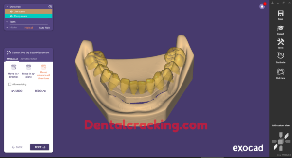 Exocad 3.2 build 9036 crack (2024) - Image 2