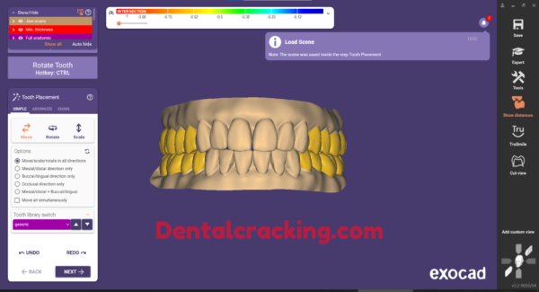 Exocad 3.2 build 9036 crack (2024) - Image 3