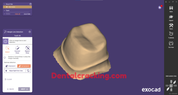 Exocad 3.2 build 9036 crack (2024) - Image 4