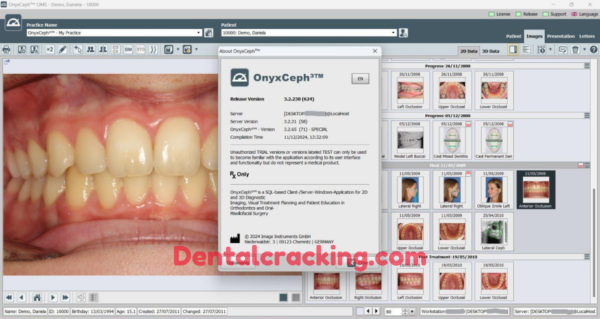 Onyxceph Software