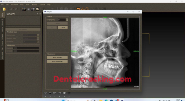 DDS Pro 2024 Crack - Image 2