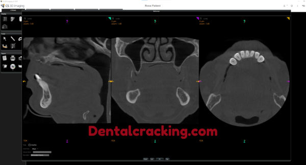 CS Imaging 2024 Crack - Image 2
