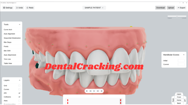 ArchForm 2.2.1 Crack Direct Print Aligner