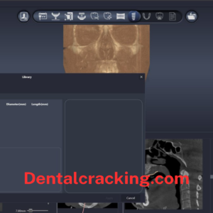 DentiqGuide 1.3.04 Crack 2025