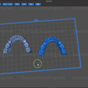 chitubox dental cracks