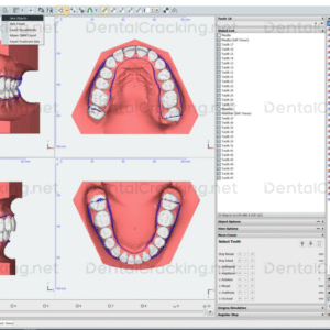 OnyxCeph 3.2.233 Crack